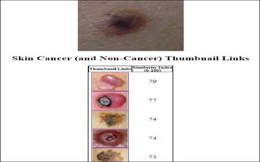 Skin Cancer Image Search网页截图,Skin Cancer Image Search网页快照